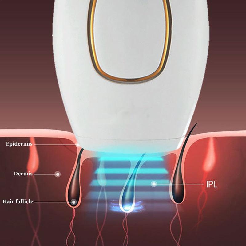 Depilador a Laser Definitivo Importado - LaserDepil - Conectta Web